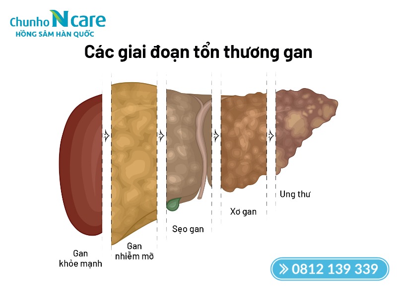 Hồng sâm giúp hình thành chiếc “áo giáp” bảo vệ gan hiệu quả